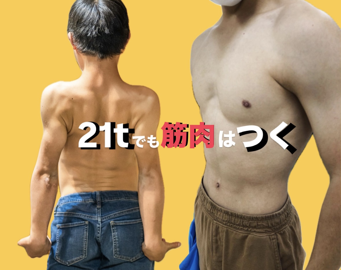 ダウン症・障がい児ダンス：サニーフラワーダンス